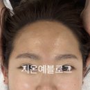 스킨 블레스 이미지