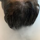 망포지하차도 | 망포미용실 메종드헤어0403 나노힐클리닉 혜원 실장님 후기