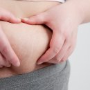 비만군 40% “GLP-1 치료제 관심 없다”… 다이어트 실패 경험이 인식 좌우 이미지