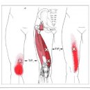 Vastus Medialis (내측광근) 이미지