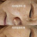 숨 피부관리 이미지