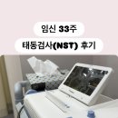 NST | 임신 33주 태동검사 후기 및 NST 시기, 수축 그래프 수치, 비용, 비급여 환급