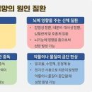 섬망 및 (섬망증 증세) 이미지