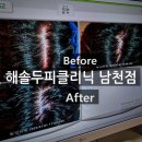 뉴트리테라피 | 부산 남천동 문제성두피관리 탈모 헤솔두피클리닉 남천점 솔직후기