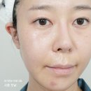 나노전류 홈케어 디바이스 집 할로 ZIIP HALO 컨덕티브 젤로 스페셜 케어 가능