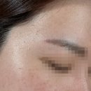 강피부과의원 | 강남역피부과 포텐자 레이저 솔직후기✨ 6번째 재방문 이유는?