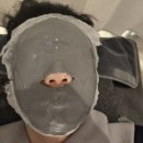 영광한의원 | 천안 불당동 천안여드름한의원 여드름흉터 없애기 3회차 새살차침과 사마귀제거 리젠부스터