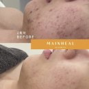 힐메디의원 이미지