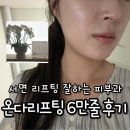 바로서면병원 | 부산 서면 온다리프팅 잘하는 곳 6만줄 후기
