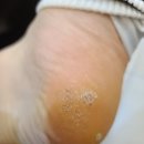 월성탑한의원 이미지