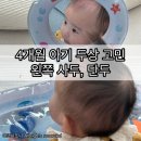 4개월 아기 왼쪽 사두, 단두로 두상 교정 헬멧 고민 (아이누오 두상베개)