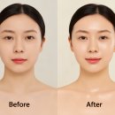 진화 주식회사 | 광채부터 탄력까지 동시에 관리하는 뷰티 디바이스 효과, 올인원 홈케어의 진화
