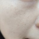 동탄예쁨주의쁨의원