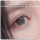 (VOM)봄안과의원 | 안검하수 재수술 비용과 후기 알아보기, 안과 부작용 해결 시기