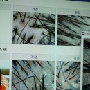 씨유 포항원리대로점 | 포항 죽도동 두피 관리 인디자인 두피 탈모 센터 본점 정수리 냄새