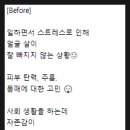 피부관리숨앤결