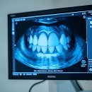 나이스치과의원 | 미금역 7번 출구 띵가띵가하다가 인생 치과 찾음요!