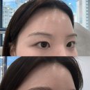 아시아프라자 앞 | 동탄 브로우리프트펌 후기 반송동 눈썹문신 잘하는곳 <새로이채움> 자연눈썹 헤어스트록