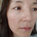 [신사동 피부관리 후기] 피부트러블 구름에서 관리했어요