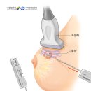 현대방사선기계 네이버블로그