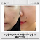 창원 스킨플래닝 추천! 인투미에서 관리 받기