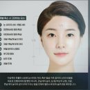 닥터미성형외과의원 | 강남 닥터미성형외과의원 콧볼축소 수술 소개
