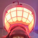 웰킨 | 부산두피관리 민감두피 케어 후기 웰킨두피탈모센타부산대점