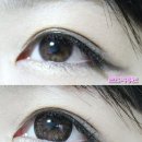 초코메디칼 이미지