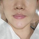 메드솔루션 | 성남 피부관리 더예쁨 윤곽관리 잘하는 에스테틱 (이마트 성남점 근처)