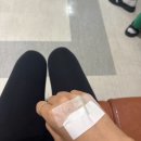 담낭 제거 수술 후기 쓸개 제거 수술 후기