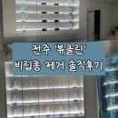 클린엔 | 전주 '뷰클린' 비립종 제거 솔직후기｜신시가지 피부관리