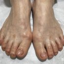 매료네일 문제성전문점 이미지