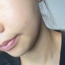 주식회사 케이디와이코스메틱 | AHC 캡처 솔루션 시그니처 앰플 일주일 사용후기