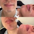 유니브로우 - 아산시 | 남여 피부관리, 페이스왁싱 - 디자인눈썹 왁싱, 눈썹정리, 남자 턱수염왁싱, 인중 왁싱 / 유니브로우 후기