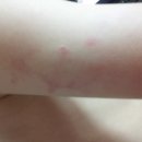 온애
