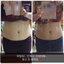 막고있는 셀룰라이트부터 빨리 녹여내는게 가장 급선무~그래서 열관리열관리 노래부르죠~(아임쏙 공식상담)