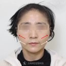 스타성형외과의원 | 1인성형외과, 원장님이 너무 바쁜 거 아닌가요?