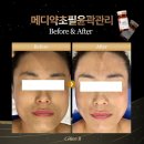 경락관리 이미지