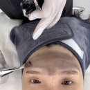 대구 동구 뷰티힐링소에서 카본토닝 흑자 레이저관리 후기