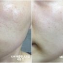 애플크럽 이미지