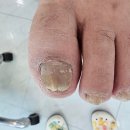 바른네일레푸스 이미지