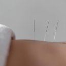 통달한의원 이미지