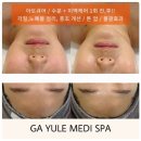 대구학정초등학교 | 대구북구피부관리 가율메디스파 아트큐어 솔직후기