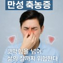만성 축농증 진단받은 리얼 후기 증상, 검사, 치료까지