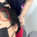 홍화 | 대구 효목동 ‘홍화뷰티’ | 헤어라인 시술 전후 비교 후기