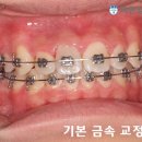 더나은치과기공소 이미지