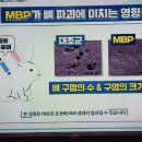 골다공증예방약 MBP 이미지