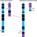 필라델피아 염색체....BCR-ABL 도대체 뭐야? 이미지
