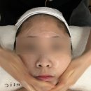 [경기광주] 엘리니아 숲 | 경기광주피부관리 | 하이푸리프팅+채움실 가격, 후기
