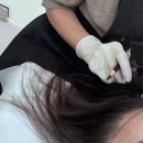 올라뷰티 | 성수 헤어라인 교정 잘하는 곳, 올라뷰티💆🏻‍♀️